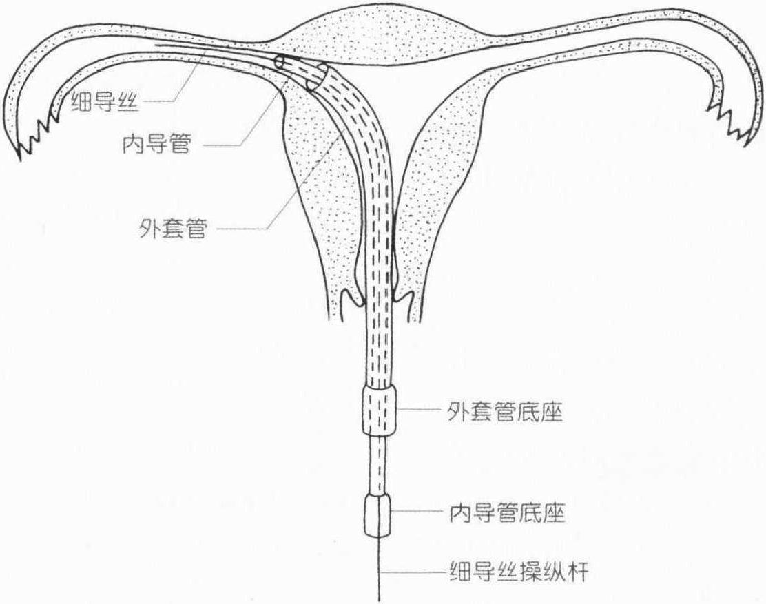 图2-6 子宫和输卵管的形态-妇产科学-医学